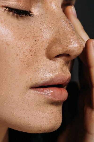 Pigmentācijas skartai ādai